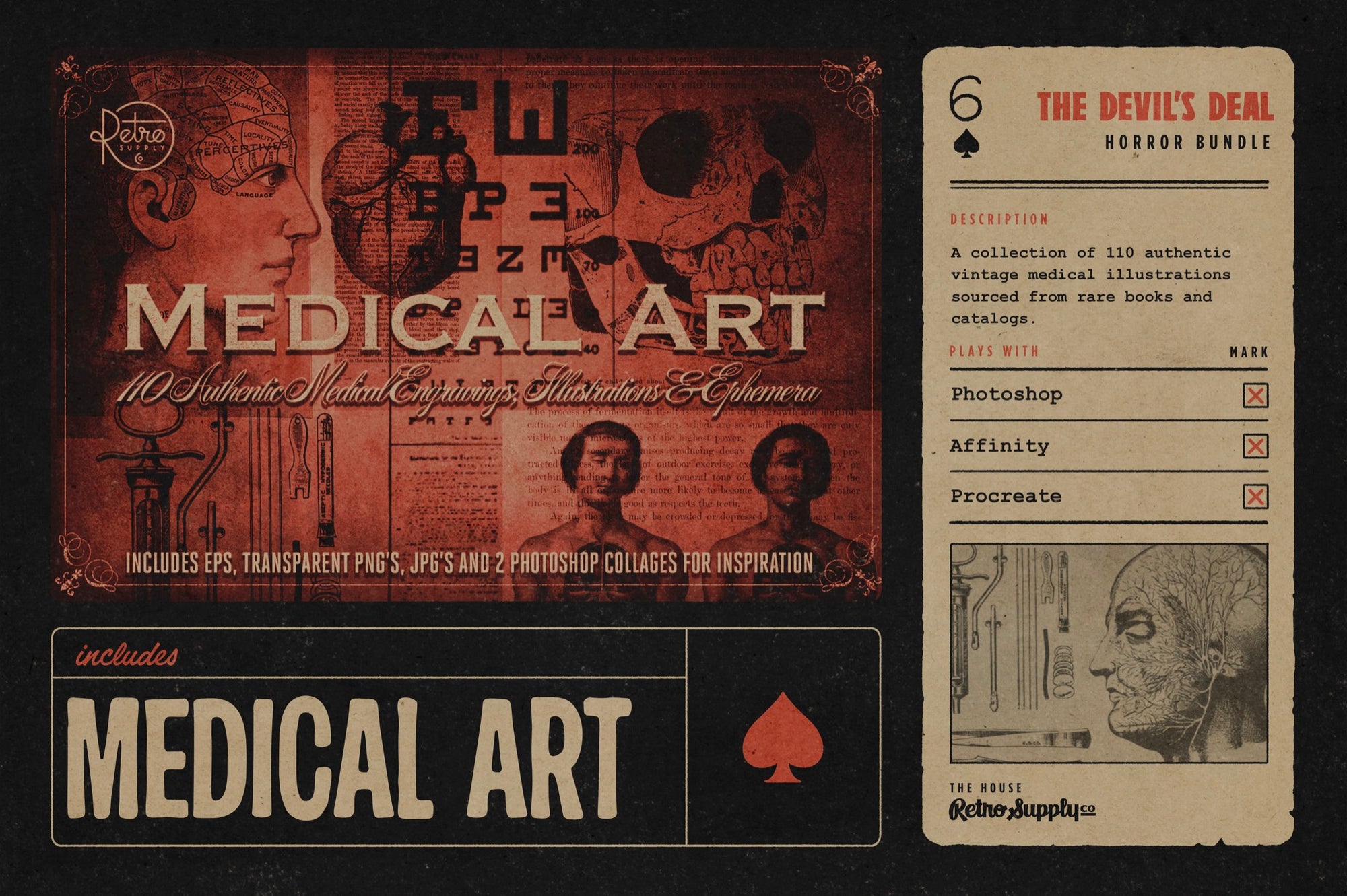Medical Art vintage clip art included in The Devil's Deal, 110 authentic medical engravings and illustrations sourced from rare books and catalogs